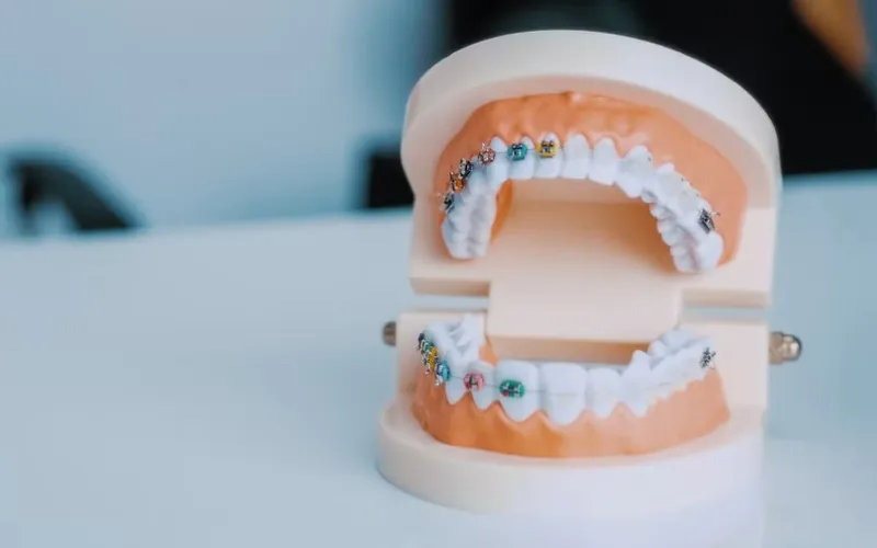 Odontología Estética